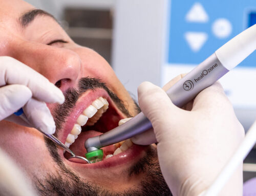 Ozono terapia in odontoiatria