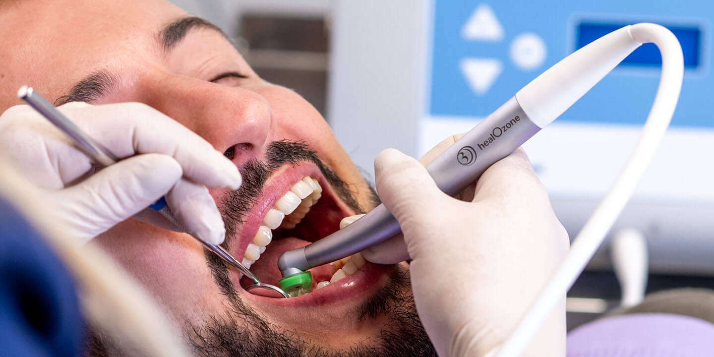 Ozono terapia in odontoiatria