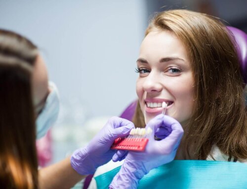 5 consigli per mantenere i denti bianchi nel tempo dopo un trattamento sbiancante