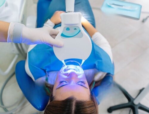 Sbiancamento dentale: Professionale vs Fai da te
